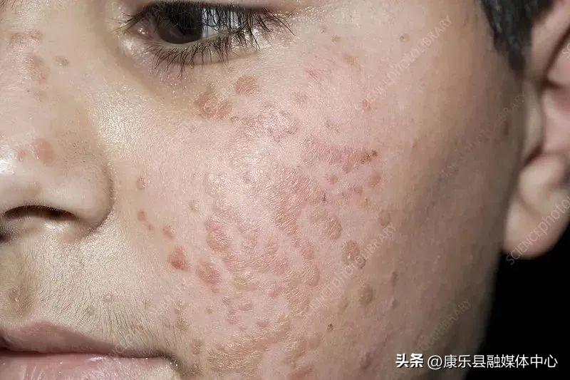 第464页